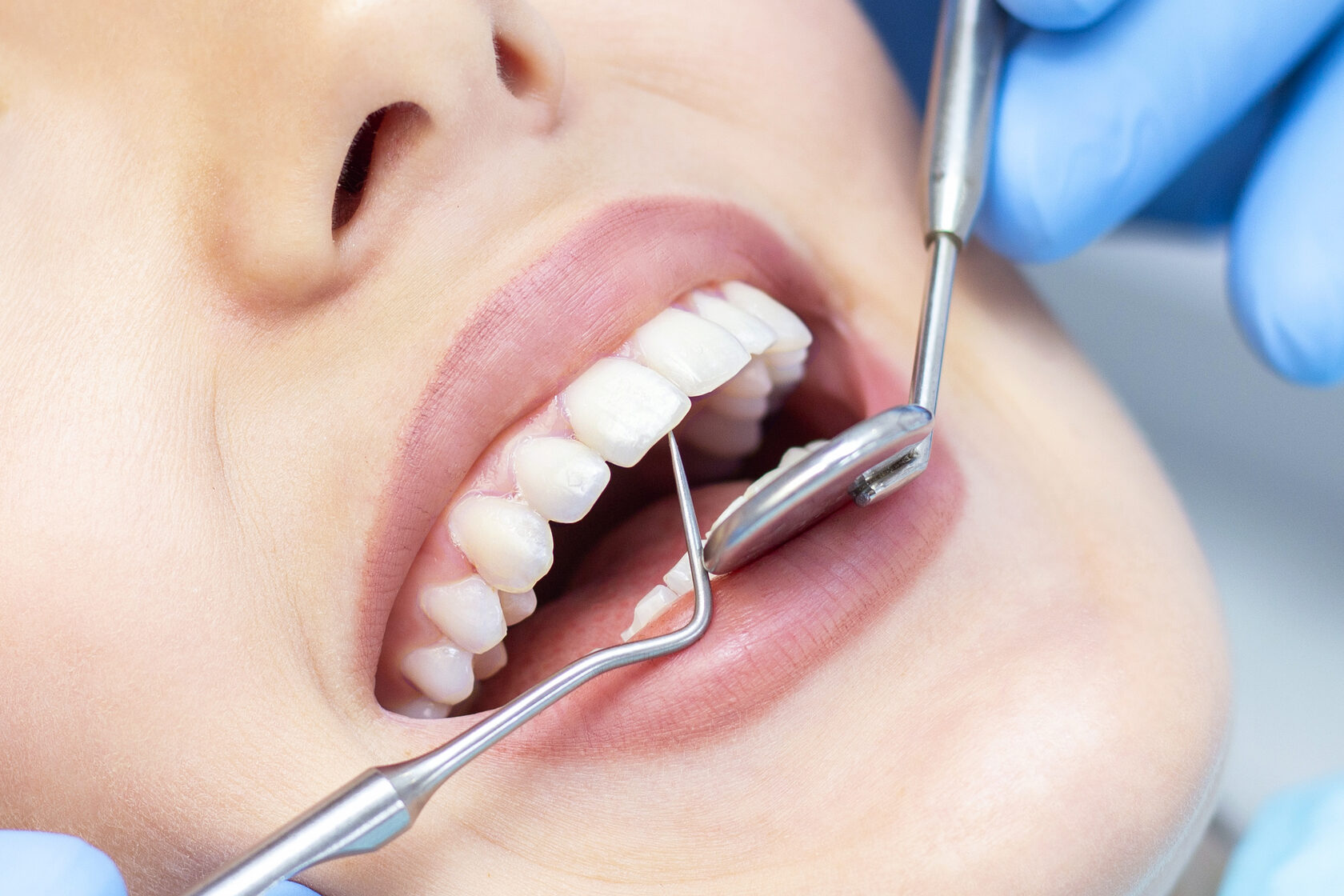 Забота о здоровье: Лучшие Методы Лечения Зубов в Мытищах